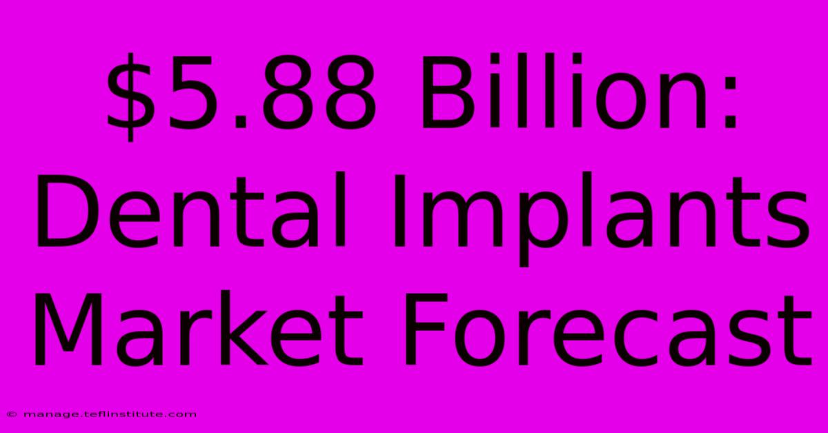 $5.88 Billion: Dental Implants Market Forecast