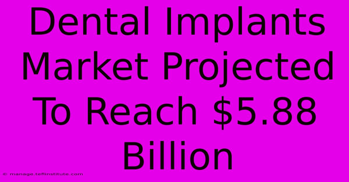 Dental Implants Market Projected To Reach $5.88 Billion 