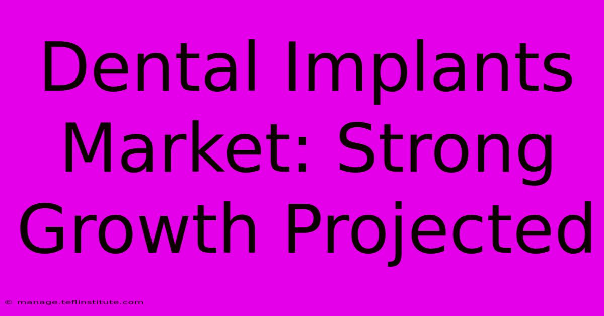 Dental Implants Market: Strong Growth Projected